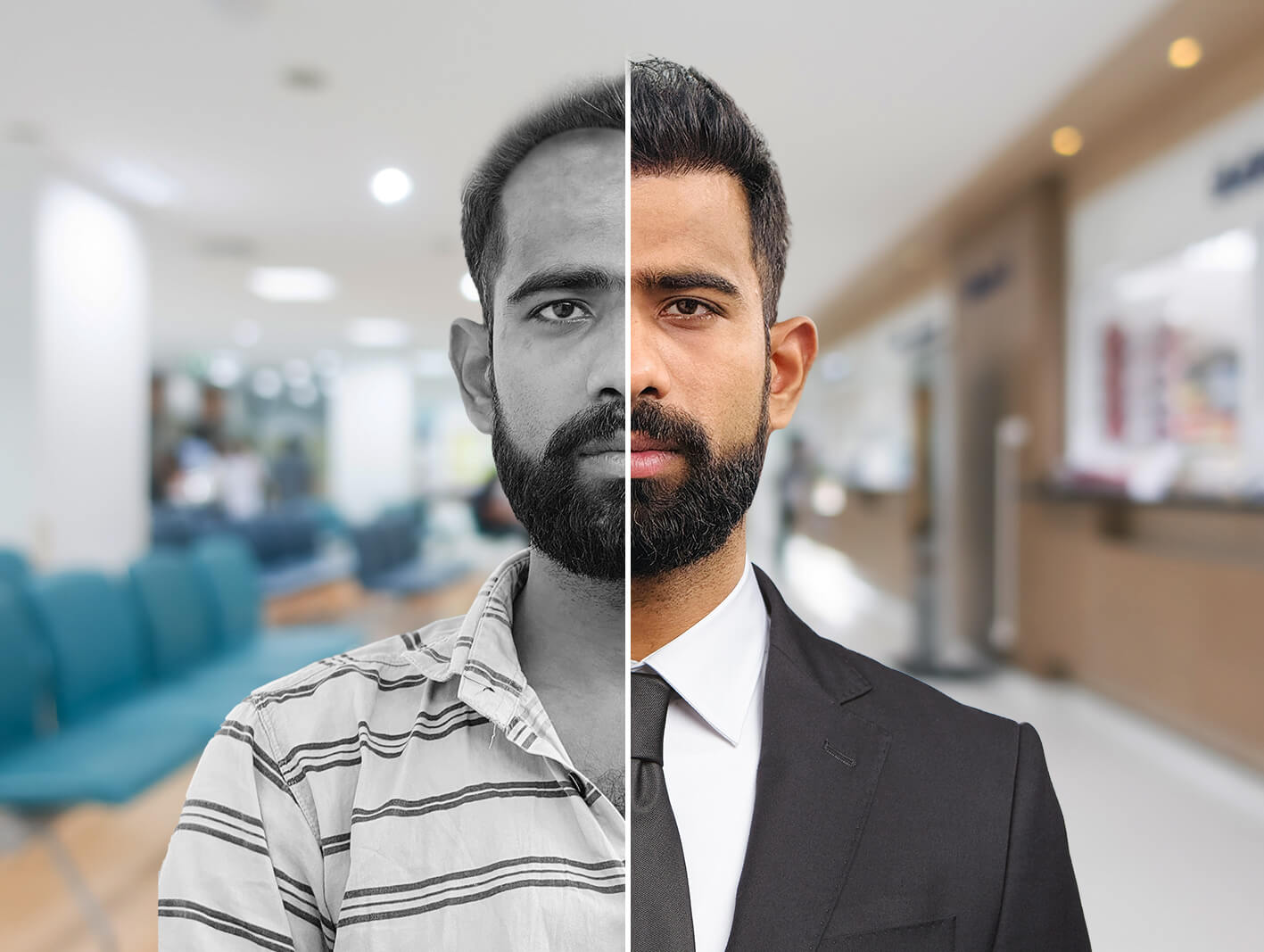 Natural hairline restoration